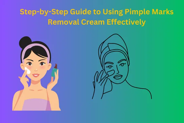 Pimple Marks Removal Cream