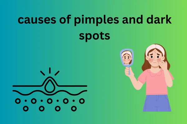 best face wash for pimples and dark spots