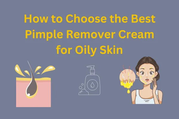 Best Pimple Remover Creams for Oily Skin