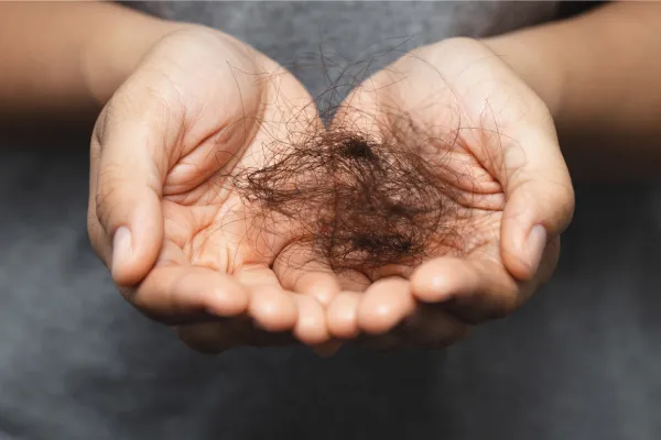 Ayurvedic Treatment for Hair Loss and Regrowth