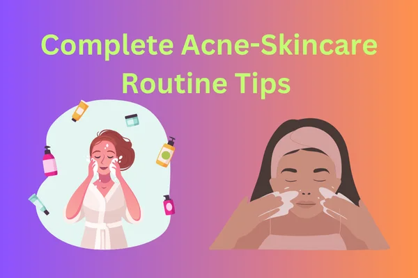 Face Cream for Pimples: The Ultimate Guide to Clearer Skin