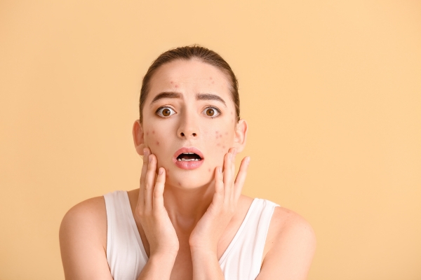 Say Goodbye to Acne with the Ultimate Pimple Clear Face Wash