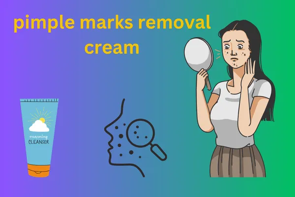 Pimple Marks Removal Cream