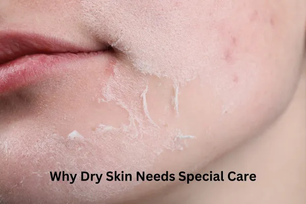 The Ultimate Guide to Choosing the Best Face Wash for Dry Skin