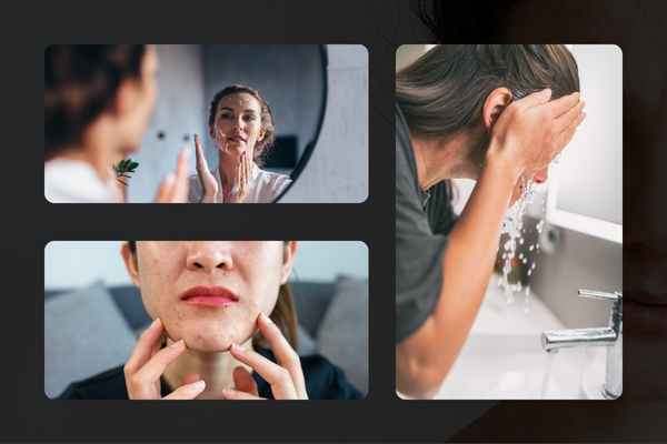 The Best Face Wash for Oily Skin and Acne – Your Complete Guide