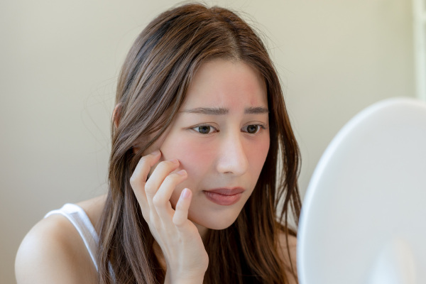 Best Moisturizer for Dry Skin