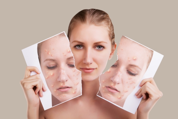 Glow Naturally: How to Brighten Skin for a Radiant You