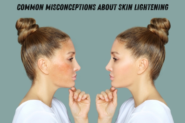 How to Lighten Skin Safely, Effectively and Naturally