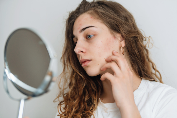 Best Moisturizer for Dry Skin