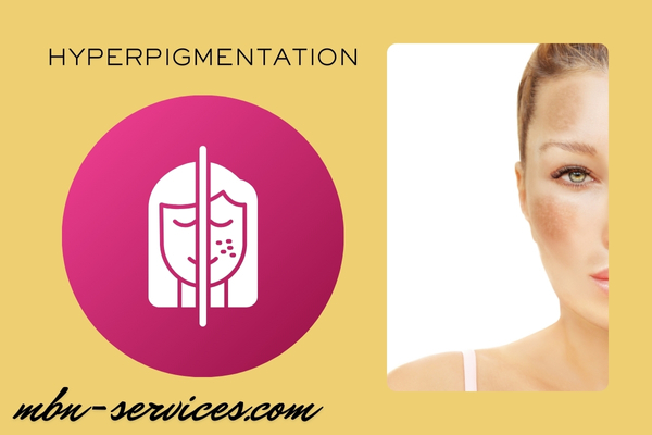 Skin Whitening Laser Treatment