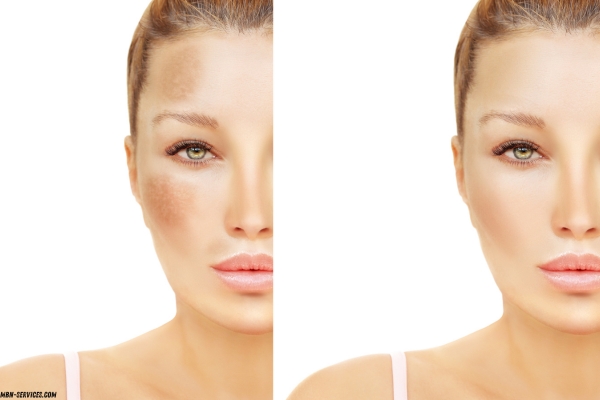 Dark Spot Correcting Serum: Your Guide to Brighter, Spotless Skin