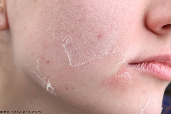 Dry Skin Care Routine: Your Ultimate Guide to Hydrated, Radiant Skin