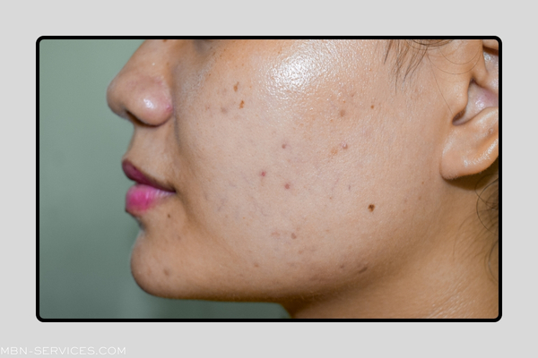 Best Serum for Dark Spots: Your Ultimate Guide to Clear Skin