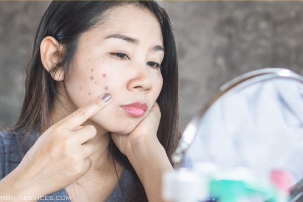 Best Serum for Dark Spots: Your Ultimate Guide to Clear Skin