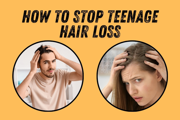 How to Stop Teenage Hair Loss