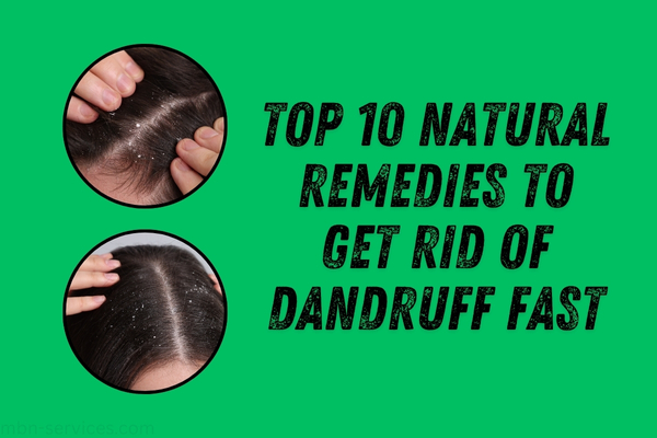 Top 10 Natural Remedies to Get Rid of Dandruff Fast